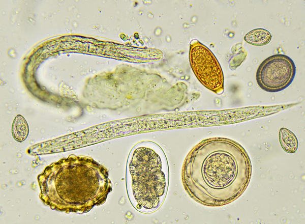 Clinical Parasitology Lecture