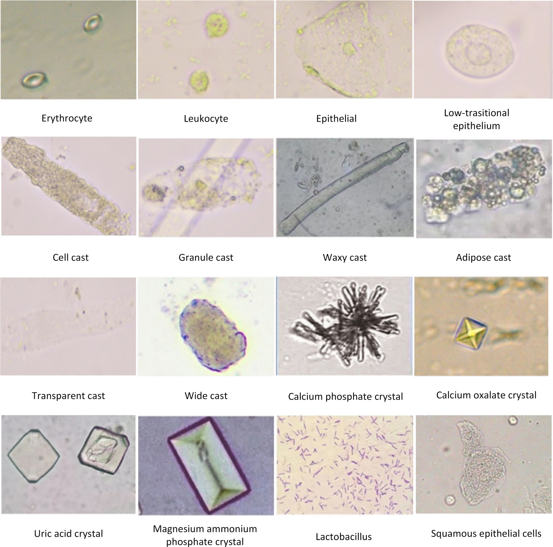 5334 Analysis of Urine and Body Fluids